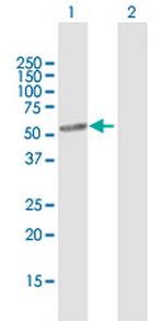 CYP46A1 Antibody in Western Blot (WB)