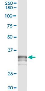 PRSS21 Antibody in Immunoprecipitation (IP)