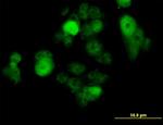 SOX30 Antibody in Immunocytochemistry (ICC/IF)