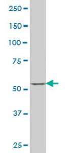 SOX30 Antibody in Western Blot (WB)