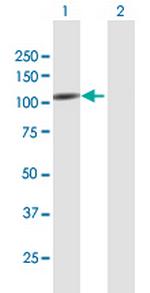 RAPGEF4 Antibody in Western Blot (WB)