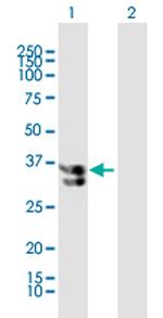 KATNA1 Antibody in Western Blot (WB)