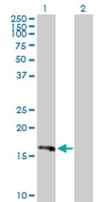 HRASLS3 Antibody in Western Blot (WB)