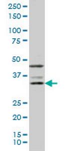 DKK1 Antibody in Western Blot (WB)