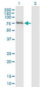 WDTC1 Antibody in Western Blot (WB)