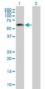 RP1-21O18.1 Antibody in Western Blot (WB)