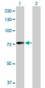 MGRN1 Antibody in Western Blot (WB)