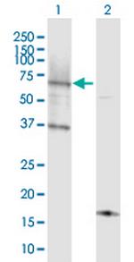 ACSL6 Antibody in Western Blot (WB)