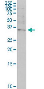 OTP Antibody in Western Blot (WB)