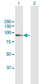 CAPN7 Antibody in Western Blot (WB)