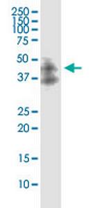 DAPK2 Antibody in Western Blot (WB)