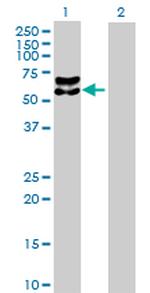 BACE1 Antibody in Western Blot (WB)