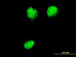 NUP62 Antibody in Immunocytochemistry (ICC/IF)
