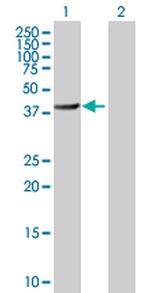 BHMT2 Antibody in Western Blot (WB)