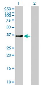 LMOD1 Antibody in Western Blot (WB)