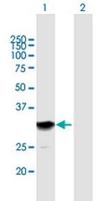 SETBP1 Antibody in Western Blot (WB)
