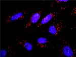 APPL1 Antibody in Proximity Ligation Assay (PLA) (PLA)