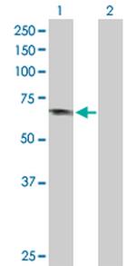 APPL1 Antibody in Western Blot (WB)