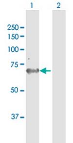 AK5 Antibody in Western Blot (WB)