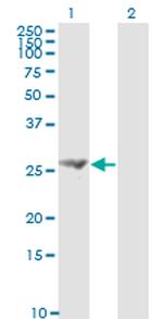 FGF21 Antibody in Western Blot (WB)