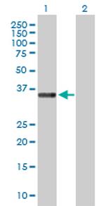 STEAP1 Antibody in Western Blot (WB)