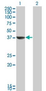 TAF5L Antibody in Western Blot (WB)