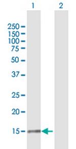 IL1F8 Antibody in Western Blot (WB)