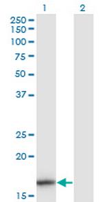 IL1F8 Antibody in Western Blot (WB)