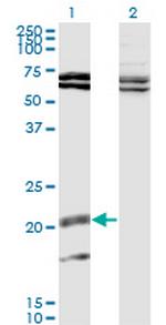 IL17B Antibody in Western Blot (WB)