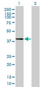 DHDH Antibody in Western Blot (WB)