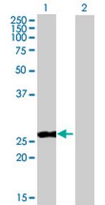 PPP2R3B Antibody in Western Blot (WB)