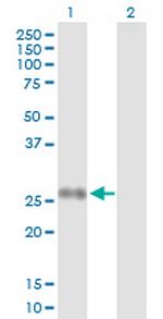 PPP2R3B Antibody in Western Blot (WB)