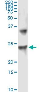 UBE2T Antibody in Immunoprecipitation (IP)