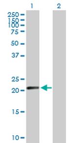 N6AMT1 Antibody in Western Blot (WB)