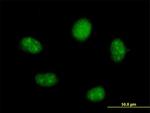 FTSJ2 Antibody in Immunocytochemistry (ICC/IF)