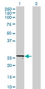 FTSJ2 Antibody in Western Blot (WB)