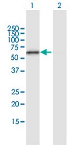 ERO1L Antibody in Western Blot (WB)