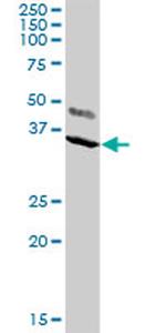 KCNIP2 Antibody in Western Blot (WB)