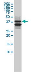 SH3GLB1 Antibody in Western Blot (WB)