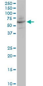 ANGPTL4 Antibody in Western Blot (WB)