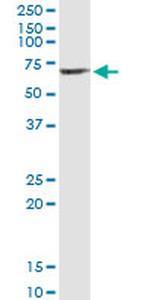 SERPINA10 Antibody in Immunoprecipitation (IP)