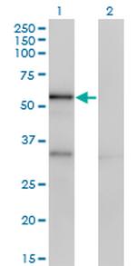 SERPINA10 Antibody in Western Blot (WB)