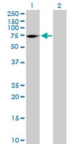 ZNF571 Antibody in Western Blot (WB)