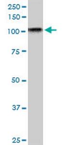 TAOK3 Antibody in Western Blot (WB)