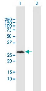 VCX3A Antibody in Western Blot (WB)