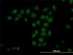 TRIM33 Antibody in Immunocytochemistry (ICC/IF)