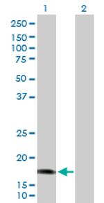 CALML5 Antibody in Western Blot (WB)