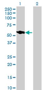 NUP54 Antibody in Western Blot (WB)