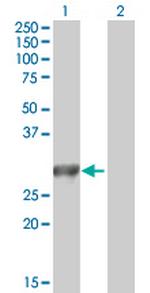 MYO3A Antibody in Western Blot (WB)