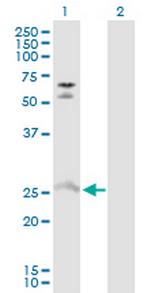 MYO3A Antibody in Western Blot (WB)